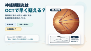 タイトルNR